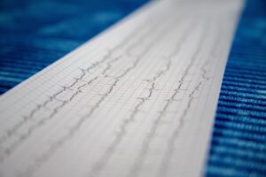 消化器内科の内視鏡検査バイトで医師が知っておくべきポイントは？